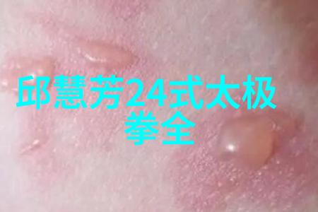 阳明山近2年共发生32起山难3人死亡