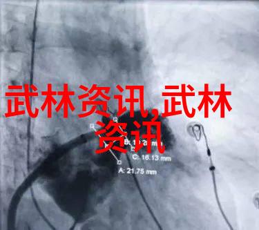 武林门派有掌门吗咏春拳舞动春韵