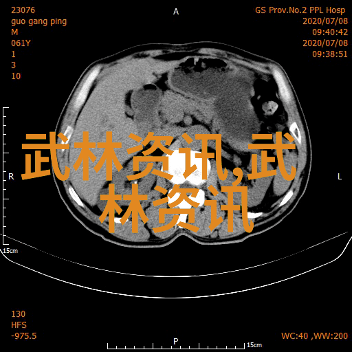 春风柔情武林佳话桃花盟咏春拳