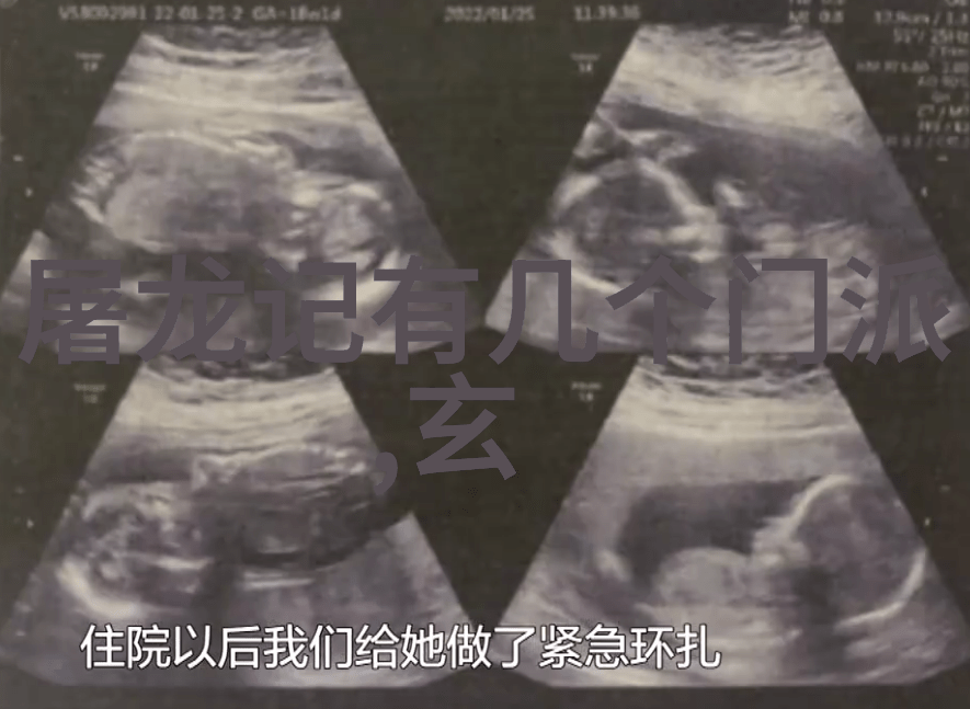 揭秘32式太极拳拳谱全套分解让你轻松练习新杨式太极拳的绝妙方法